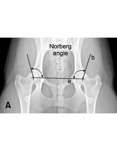 X-Ray Measurement - Norberg Angle Caliper, Sassnau pattern 2
