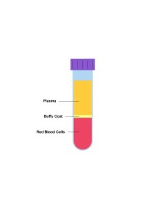 KRUUSE Blood Collection Tube, EDTA K2, 5 ml, plastic, 100/pk 2